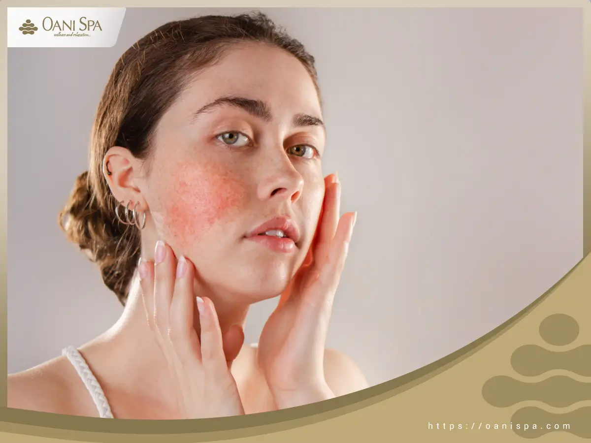 Chăm sóc da nhạy cảm Đặc điểm thường xuyên của da nhạy cảm là xuất hiện mẩn đỏ quanh mặt