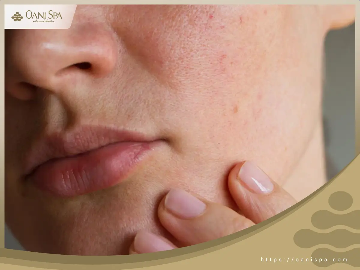 Chăm sóc da nhạy cảm Hay quan tâm đến quy trình chăm sóc da nhạy đúng cách