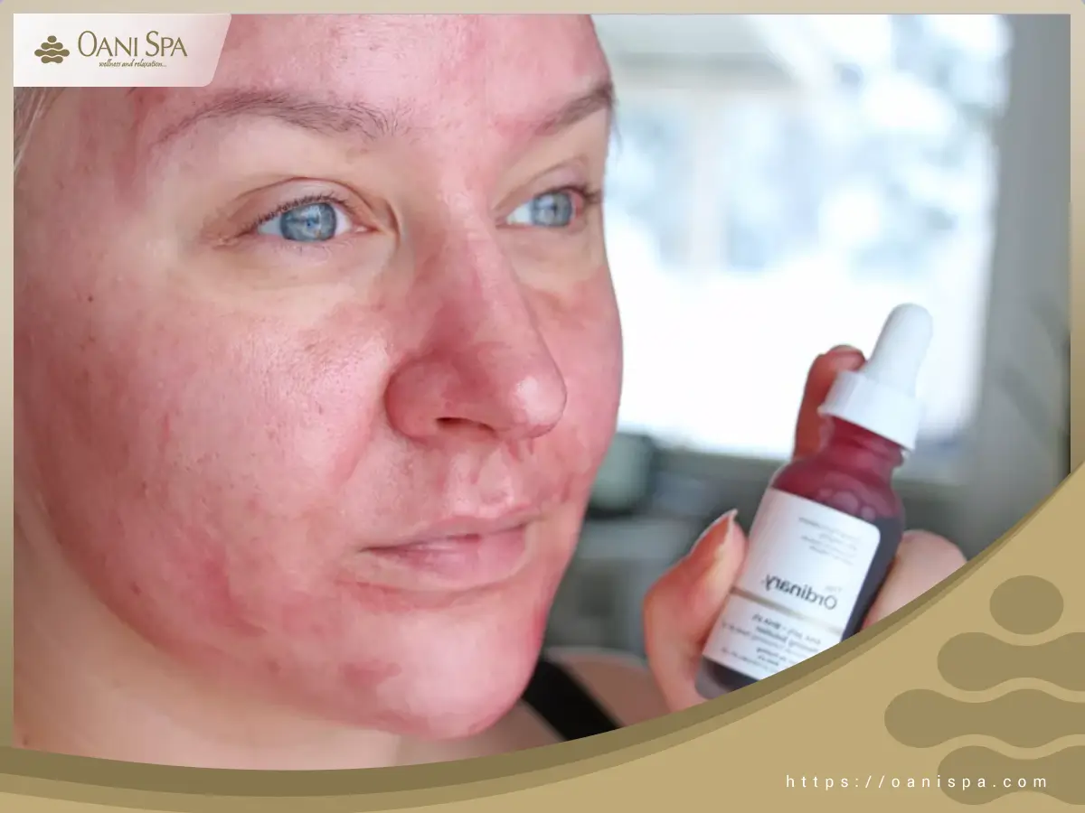 chăm sóc da sau peel chăm sóc da sau peel