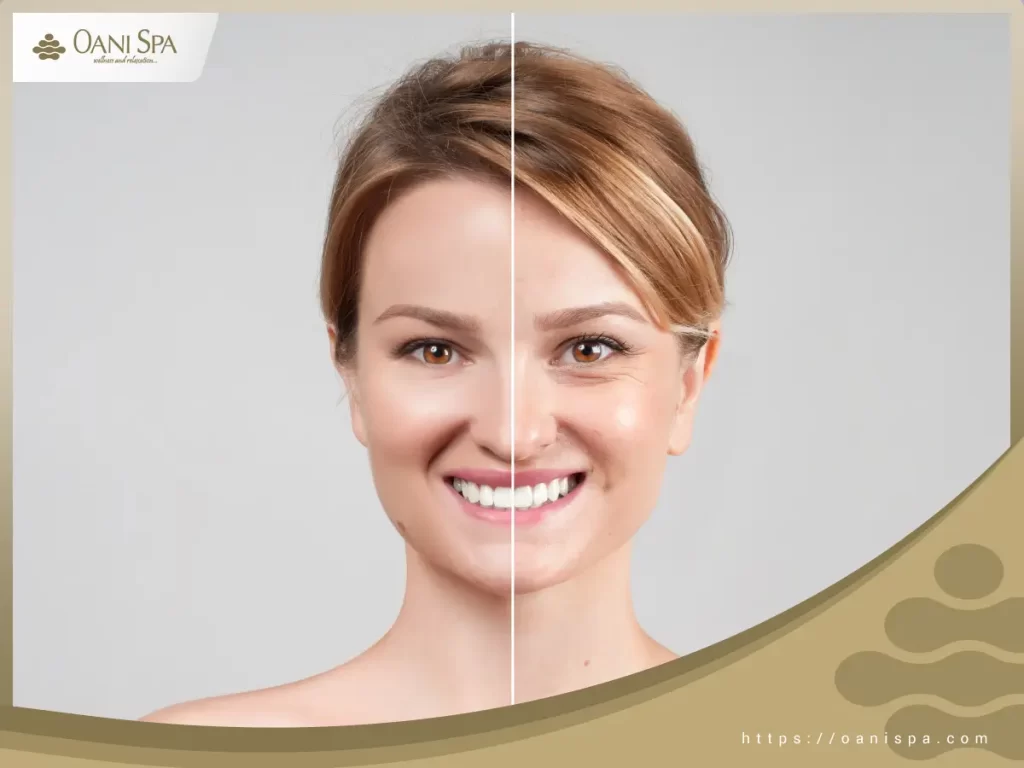 Có rất nhiều nguyên nhân kiến da bị lão hoá nhanh, từ duy truyền cho đến các tác nhân bên ngoài