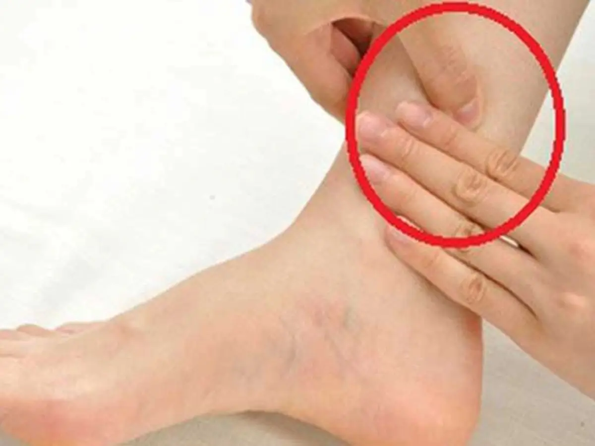 Bấm huyệt chữa tê chân Bấm huyệt chữa tê chân