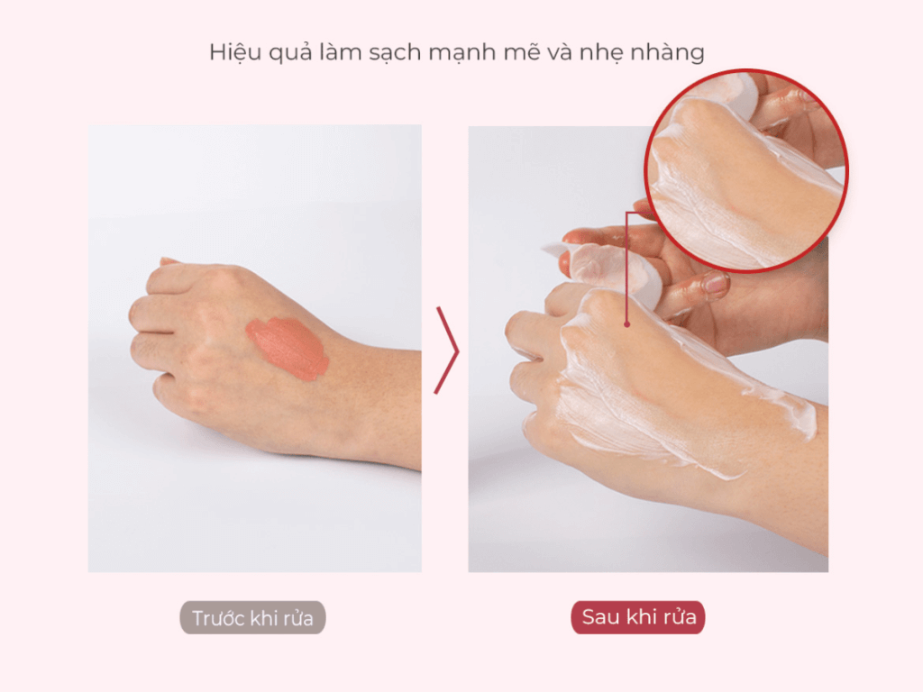 EGF Moist Cleansing Milk