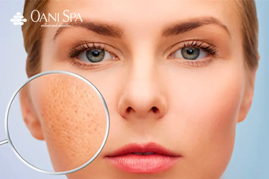 Chăm sóc da mặt bị sẹo rỗ là khả năng làm mờ sẹo.