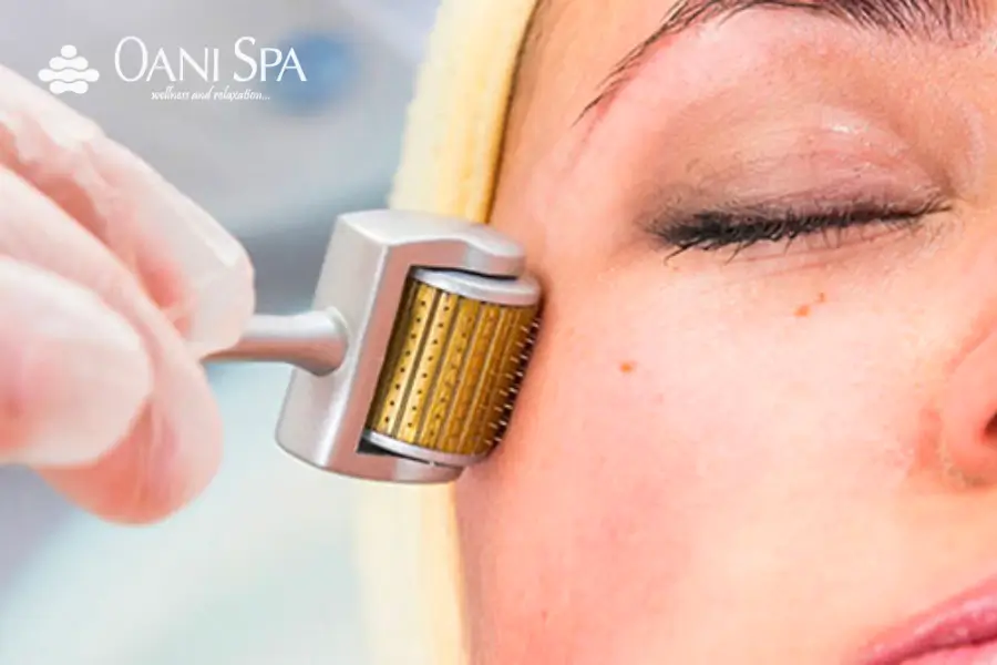 chăm sóc da mặt bị sẹo rỗ