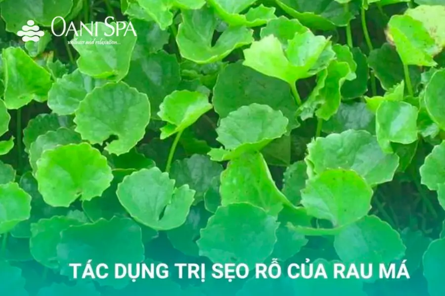 chăm sóc da mặt bị sẹo rỗ