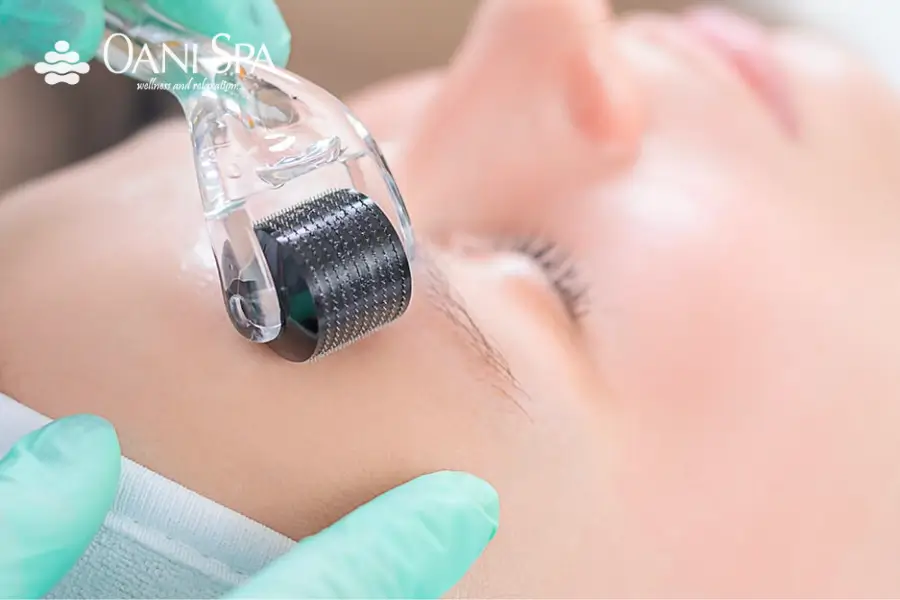 Chăm sóc da mặt sau lăn kim 