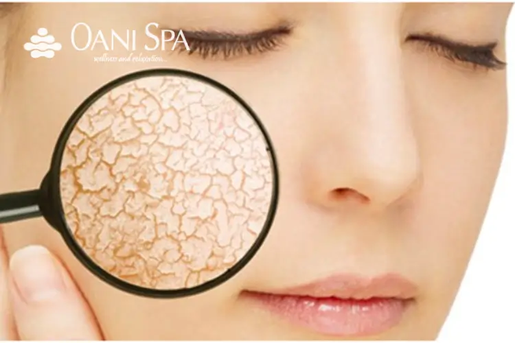 chăm sóc da mặt sau sinh Da sau sinh thường trở nên khô hơn