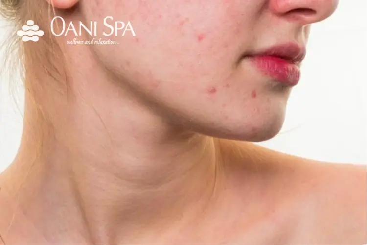 chăm sóc da mặt sau sinh chăm sóc da mặt sau sinh bằng nghệ