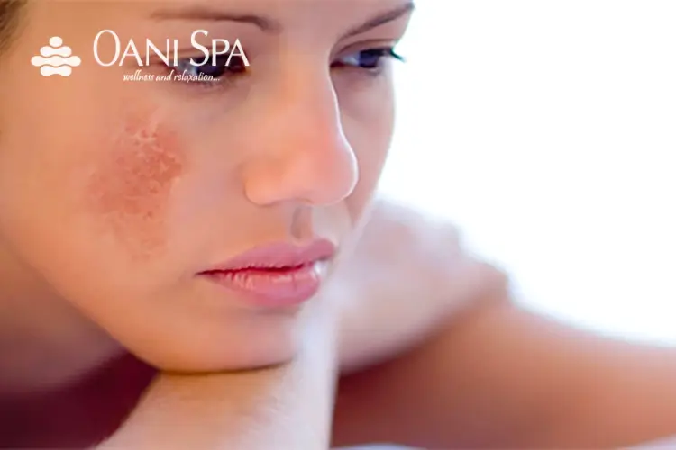 chăm sóc da mặt sau sinh Da mặt sau sinh có sự thay đổi