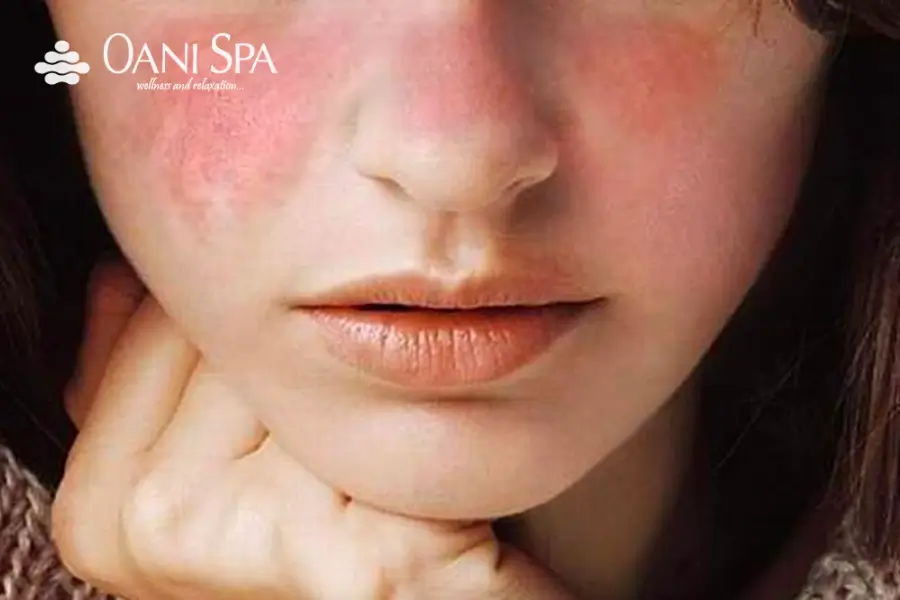 chăm sóc da tuổi dậy thì đúng cách