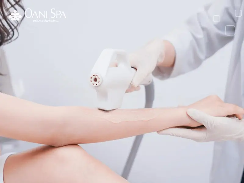 tẩy lông tay Triệt lông tây chân với công nghệ hiện đại