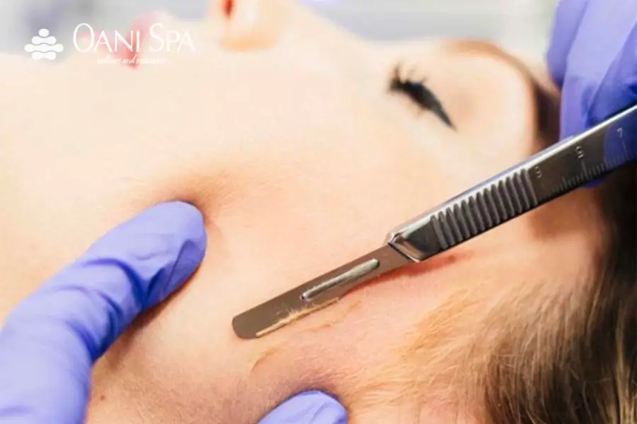 Triệt lông mặt có hại không