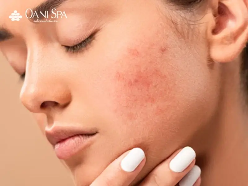 cách chăm sóc da mặt bị nám cách chăm sóc da mặt bị nám