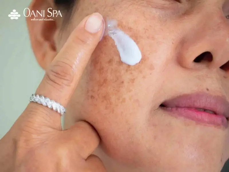 cách chăm sóc da mặt bị nám cách chăm sóc da mặt bị nám