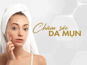 Chăm sóc da mụn