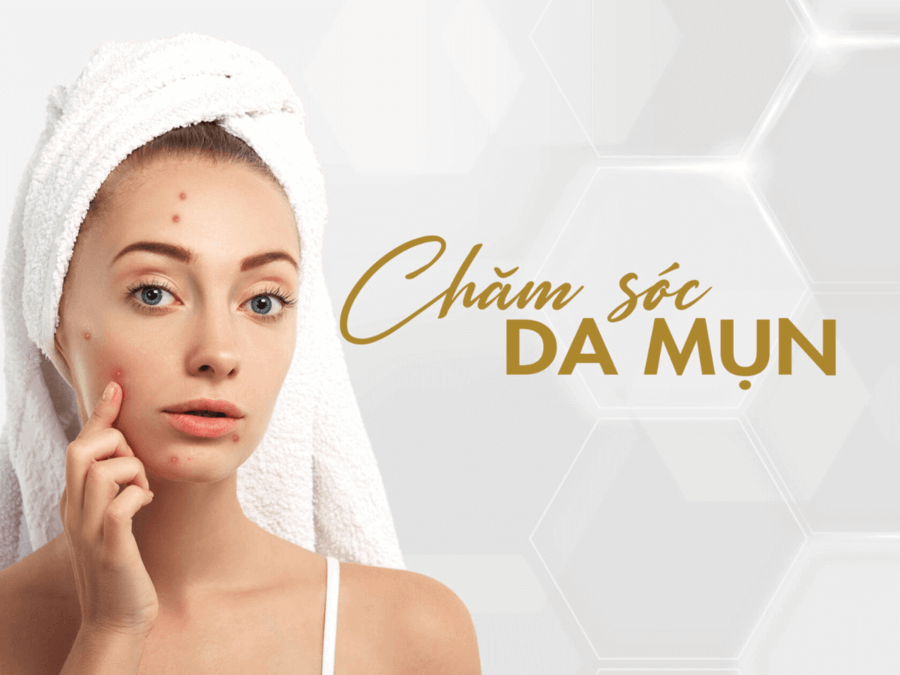 Chăm sóc da mụn